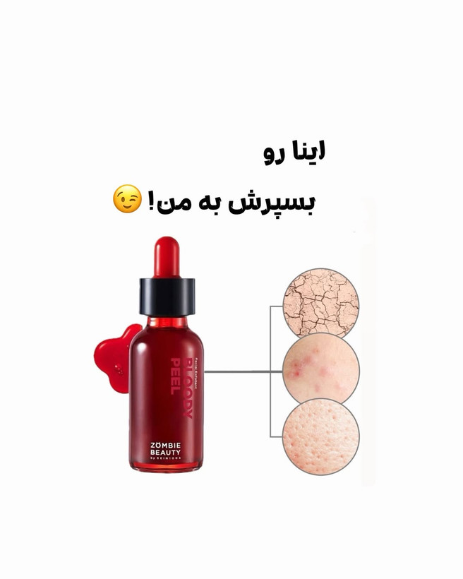 سرم پیلینگ و لایه بردار زامبی بلادی Skin1004
